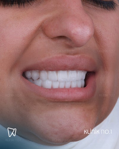 Room wanted in Bronx, NY Main Photo